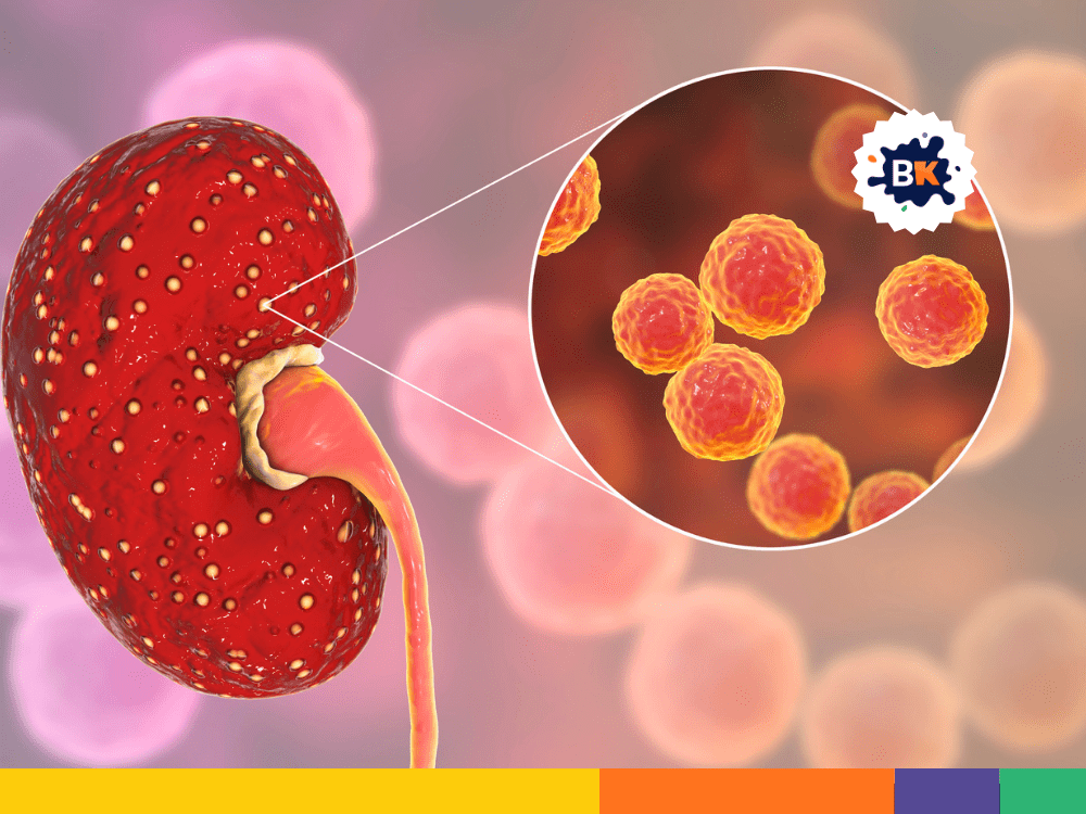 Kidney Kidney